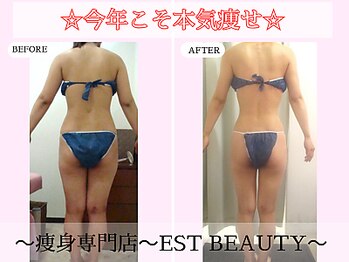 エストビューティー 池袋店(EST BEAUTY)/当サロン自慢の技術【池袋痩身】
