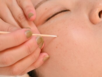 リシェル(Richelle)/●8日間のはがれるシミケア