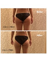 アトリス(Atriz)/張ってるムダ肉も徹底的に！