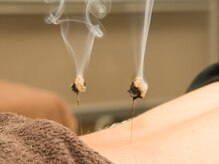 上毛鍼灸院/灸頭鍼