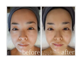 アン グレーヌ 自由が丘(unegraine)/スッピンに自信が持てる