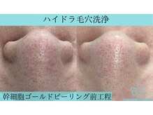 リメイククリニカルビューティー(Remake clinical beauty)/GP前の土台作りに