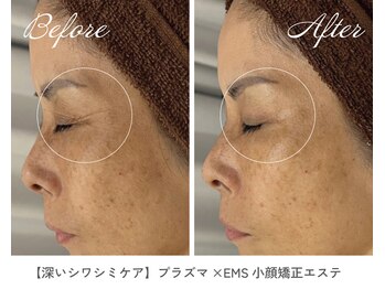 サラスヴァティー(SARASVATI)/目元のシワ/シミケア★50代女性