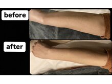 ゴッド(GOD)/ビフォーアフター