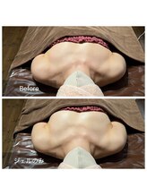 リノレア(LinoLea)/