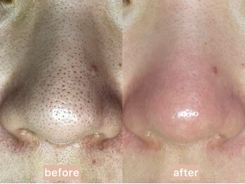 しらゆき 名古屋黒川