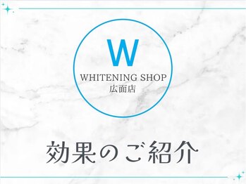 ホワイトニングショップ 広面店/圧倒的な効果を実感!
