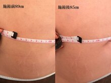 リラ(Lilas)/人生ラストダイエット