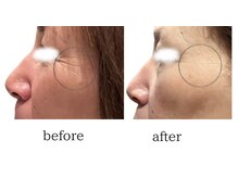 エン(EN)/フェイシャル人気NO.1