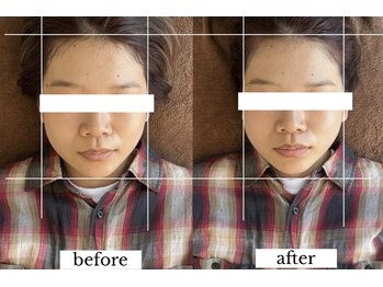 ダイアリー(DIARY)/小顔矯正