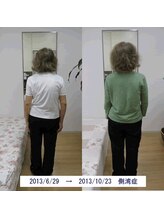 エスコート芦屋サロン/70代　側湾　胃腸の不調