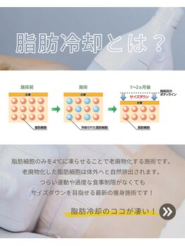 イエス マイサロン(yes My Salon)/脂肪冷却説明1