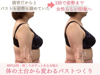ベルフルール/肩こり・猫背が気になる方/熊本
