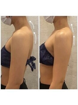 小顔フェイスラボ 春日井店(小顔 Face Labo.)/◆小顔&整体コルギで姿勢改善◆