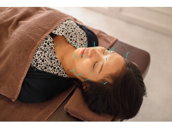 六花鍼灸整骨院 川端本店/美容鍼