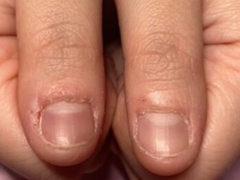 シュアム(shuam)の写真/深爪/噛み爪/割れやすいなどのお悩みを、丁寧なカウンセリング×高技術で徹底解消☆キレイなお手元を演出♪