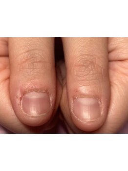 爪の悩みを解消できる（ケア含む）