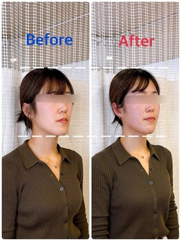 イズム まつもと店(izm)/小顔モニター様