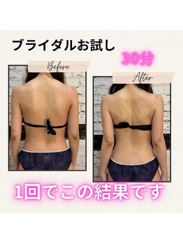 ザ レディービー(The Lady B)/ブライダルエステお試し