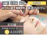 初回限定割引【圧倒的人気の美容鍼 】小顔・リフトアップ・美肌◎¥6000→4000