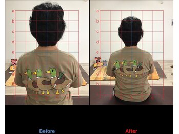 ストレチックス 近江八幡店/ストレッチ ビフォーアフター