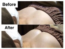 ナトゥーラ チュチュ(natura chuchu)/ボリュームアップ美バスト★梅田