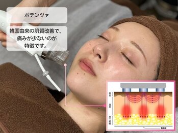 ルディラ医療提携エステ 立川店 毛穴/小顔/ニキビ・シミ・美白・シワ・たるみケア/ポテンツァ(RFマイクロニードル)
