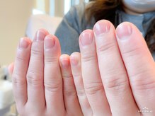 コナ(KONA)/自爪の美しさを引き出す◎