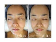 アン グレーヌ 自由が丘(unegraine)/触りたくなる！ツルスベ肌♪