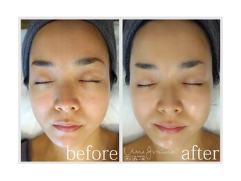 アン グレーヌ 自由が丘(unegraine)/触りたくなる！ツルスベ肌♪