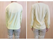 学芸大整体院/姿勢改善×背中はり/BeforeAfter