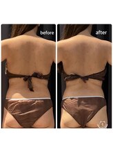 ベルフルール 西18丁目店/発汗リンパマッサージ