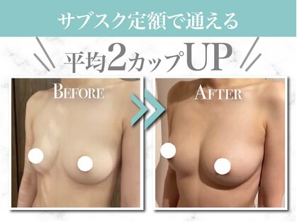 美人バスト 福岡店の写真
