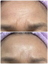 アズ(AZU)/60代女性before　After‐