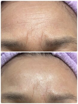 アズ(AZU)/60代女性before After‐