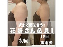 ミセル(MISEL2nd)/隠さないドレス専用ボディケア★