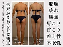 サンティエール