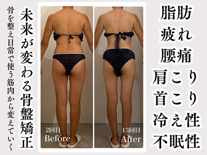 サンティエールの写真