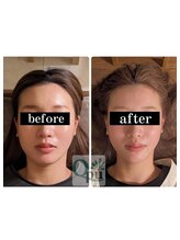 キュープ 名張店(Qpu)&nbsp;人気No,1 オイル