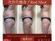 ザ サロン 726(THE SALON 726)の写真/短期集中コースで結果を出していきます！脂肪分解レモンボトルの進化版！痩身を促す成分が増量美肌ケアも◎