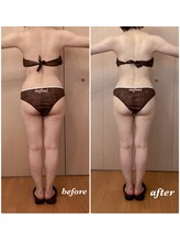 アンフィニ(infini)/短期集中コース3回（1.5ヶ月)