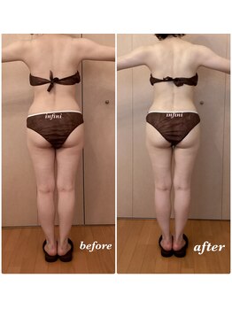 アンフィニ(infini)/短期集中コース3回(1.5ヶ月)