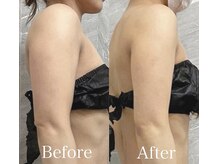 ブランシュムーニー(BRANCHE MOONY)/二の腕4カップ