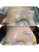 リエット(Lieto)/ムラのない美肌で素顔美人☆