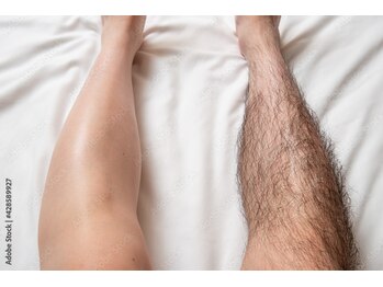 ミラ(Mira)/あし脱毛！