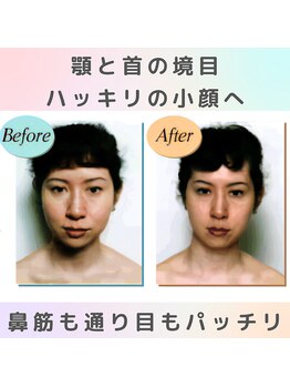 ロコモ 美容矯正サロン(Locomo)/左右対象の小顔：顔のメリハリ