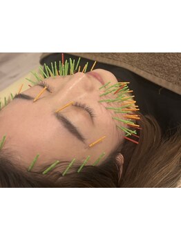 ホウレイ線・たるみ改善！予防ケア