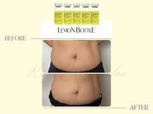 リー(Riy)/《Before and After》