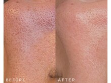 ブリリア モア(Brillia Moi)/フェイシャル