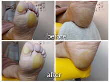 爪切り屋 足楽/「自分ではお手上げ（その２）」